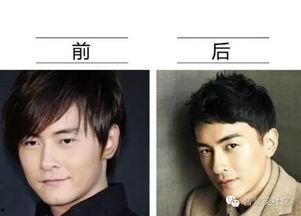 男网红整容脸吃瓜视频,吃瓜群众热议的整形真相