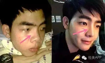 男网红整容脸吃瓜视频,吃瓜群众热议的整形真相